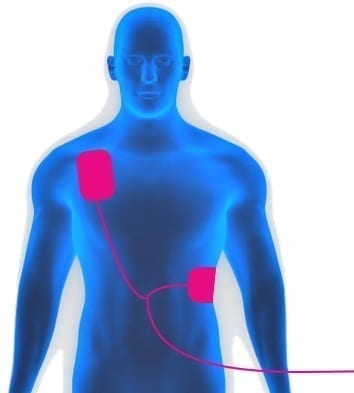 Defib AED Defibrillator Pad Placement | SkillBase First Aid