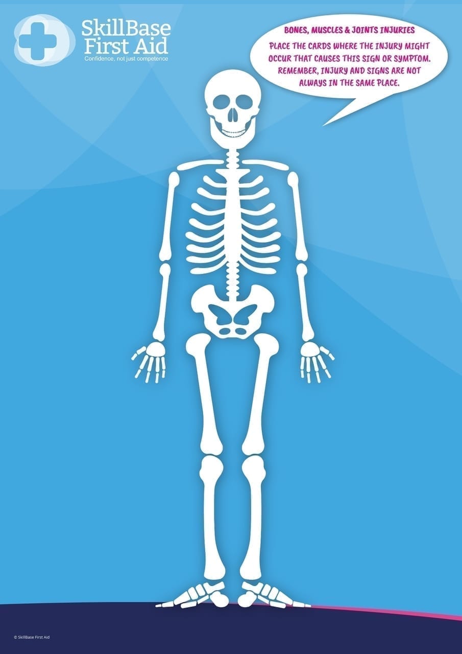 A2 Skeleton & Symptom Cards for Broken Bones Activity Set of 3